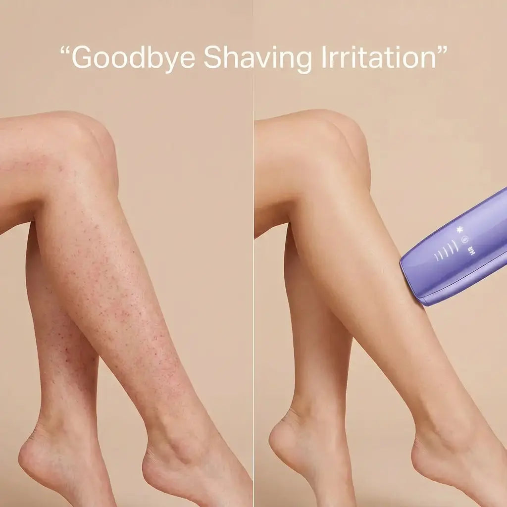 Laser Hair Removal